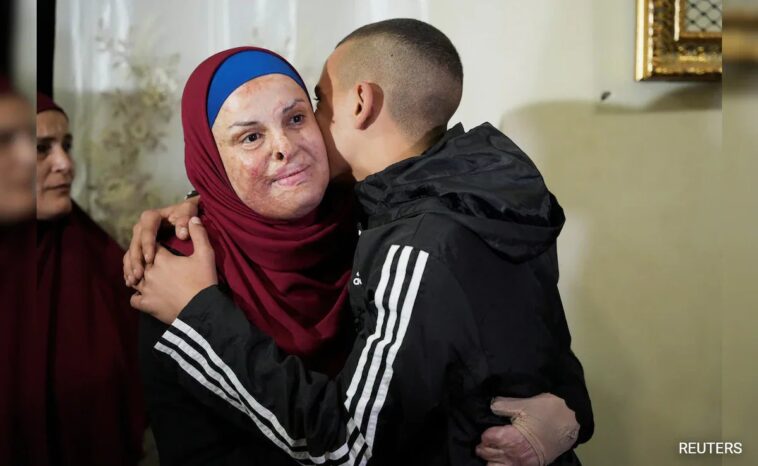 Prominent Palestinian Prisoner Israa Jaabis Released in Israel-Hamas Hostage Swap. PHOTO COURTESY